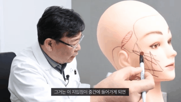 중안면거상후기, 실리프팅 먼저 알아봐야 하는 이유 관련 이미지 1