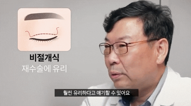 신사역눈매교정? &lsquo;쌍꺼풀 수술&rsquo;과 더 이상 헷갈리지 마세요. 관련 이미지 2