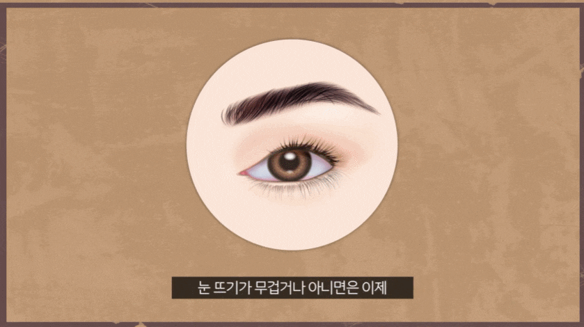 상안검수술 유명한 성형외과 찾는 분들에게 조언해 드립니다. 관련 이미지 2