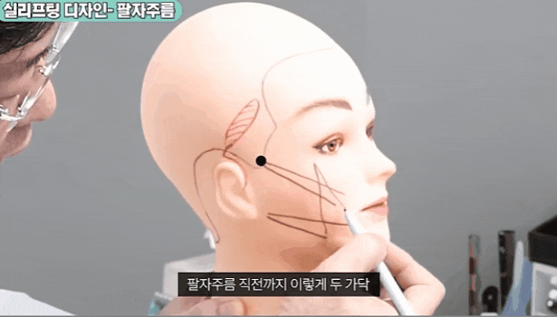 신사역 리프팅 추천 방법은? 효과와 주의사항에 대해서 관련 이미지 3