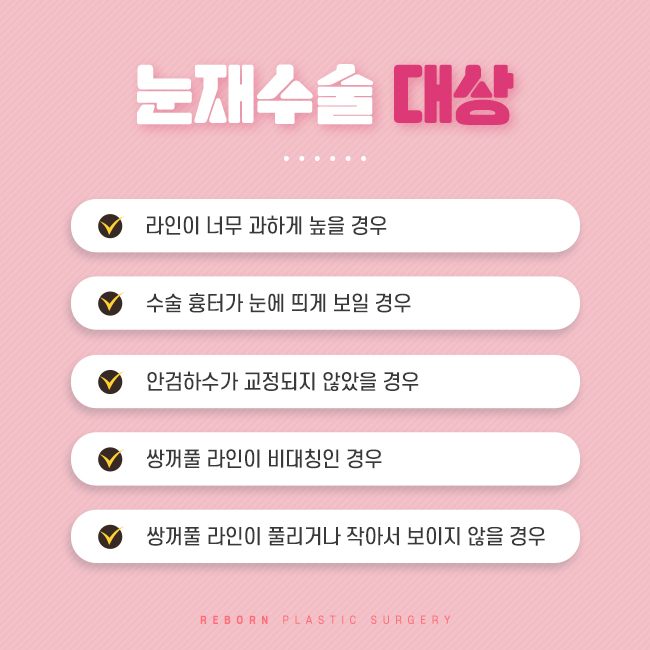 압구정눈재수술 라인 바꾸기를 원한다면 관련 이미지 3