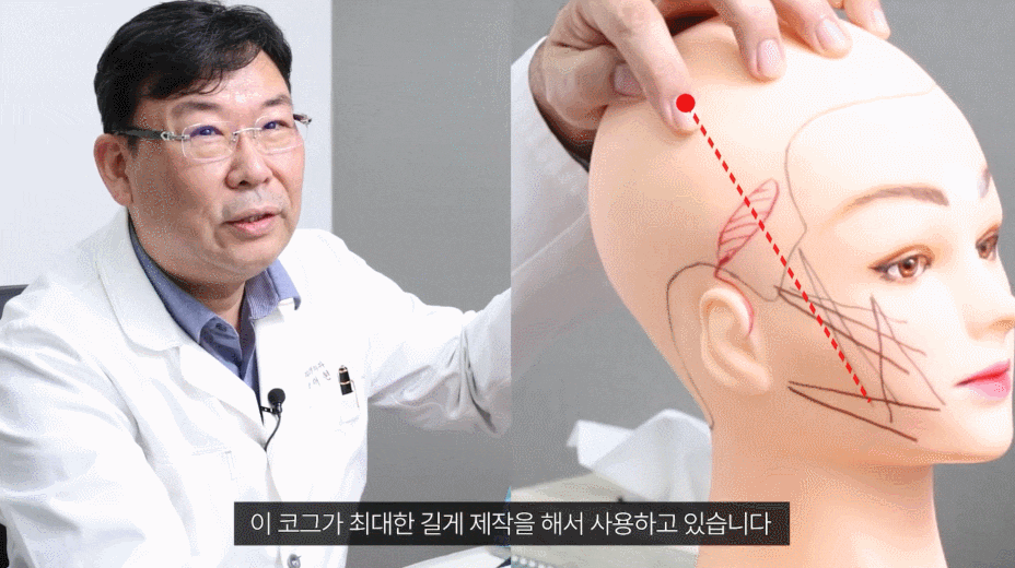 미니안면거상성형? 늘어진 눈가, 광대살 함께 개선하고 싶은 분들께 관련 이미지 5