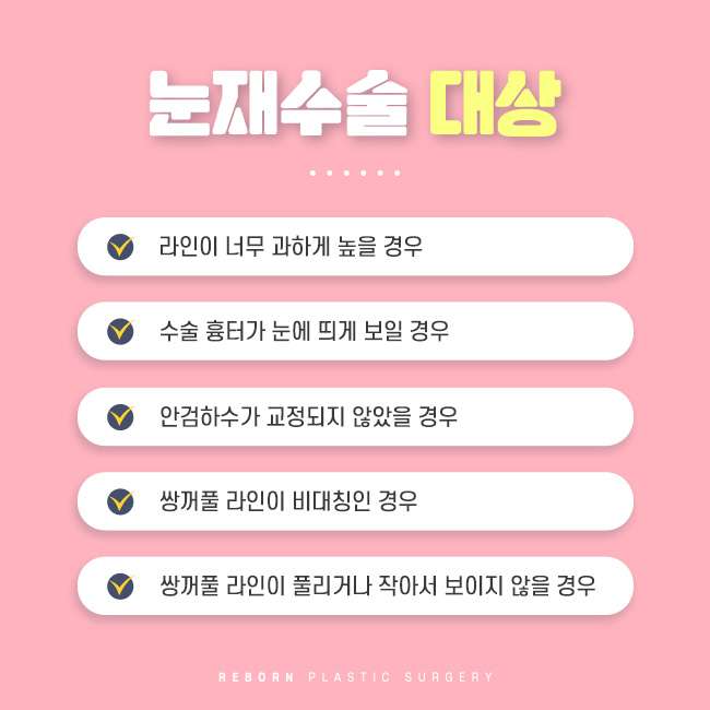 강남역눈재수술 성공을 위해 주의해야 할 것 관련 이미지 3