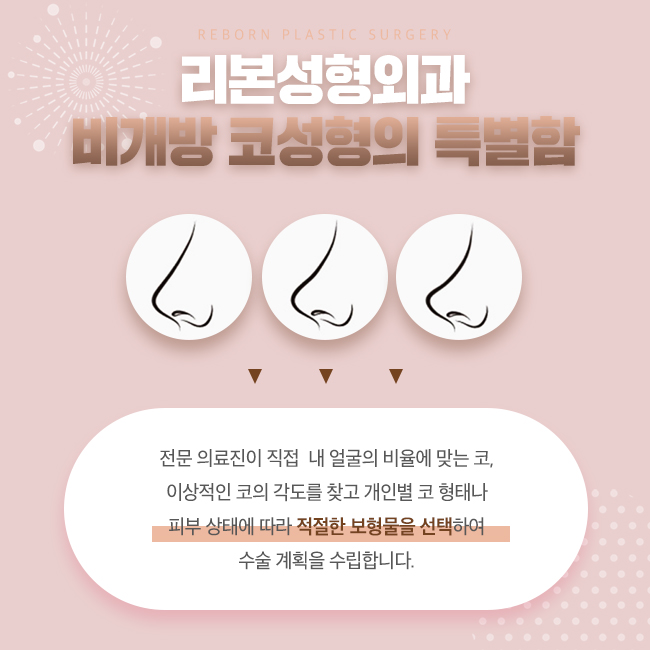 가로수길성형외과 코를 개방하지 않는 방법으로! 관련 이미지 4