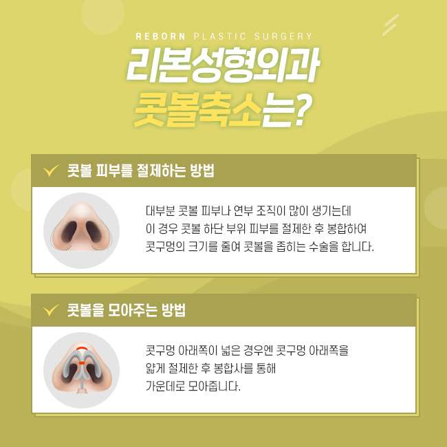 신사역성형외과 콧볼축소로 세련된 이미지 만들기 관련 이미지 3
