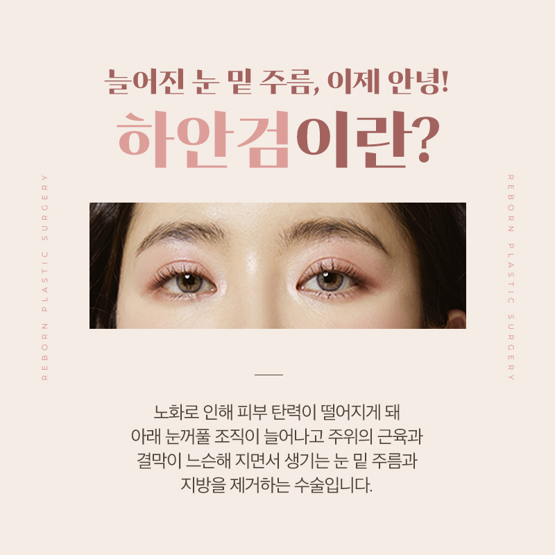 강남역성형외과 눈 밑 주름, 애교살로! 관련 이미지 2