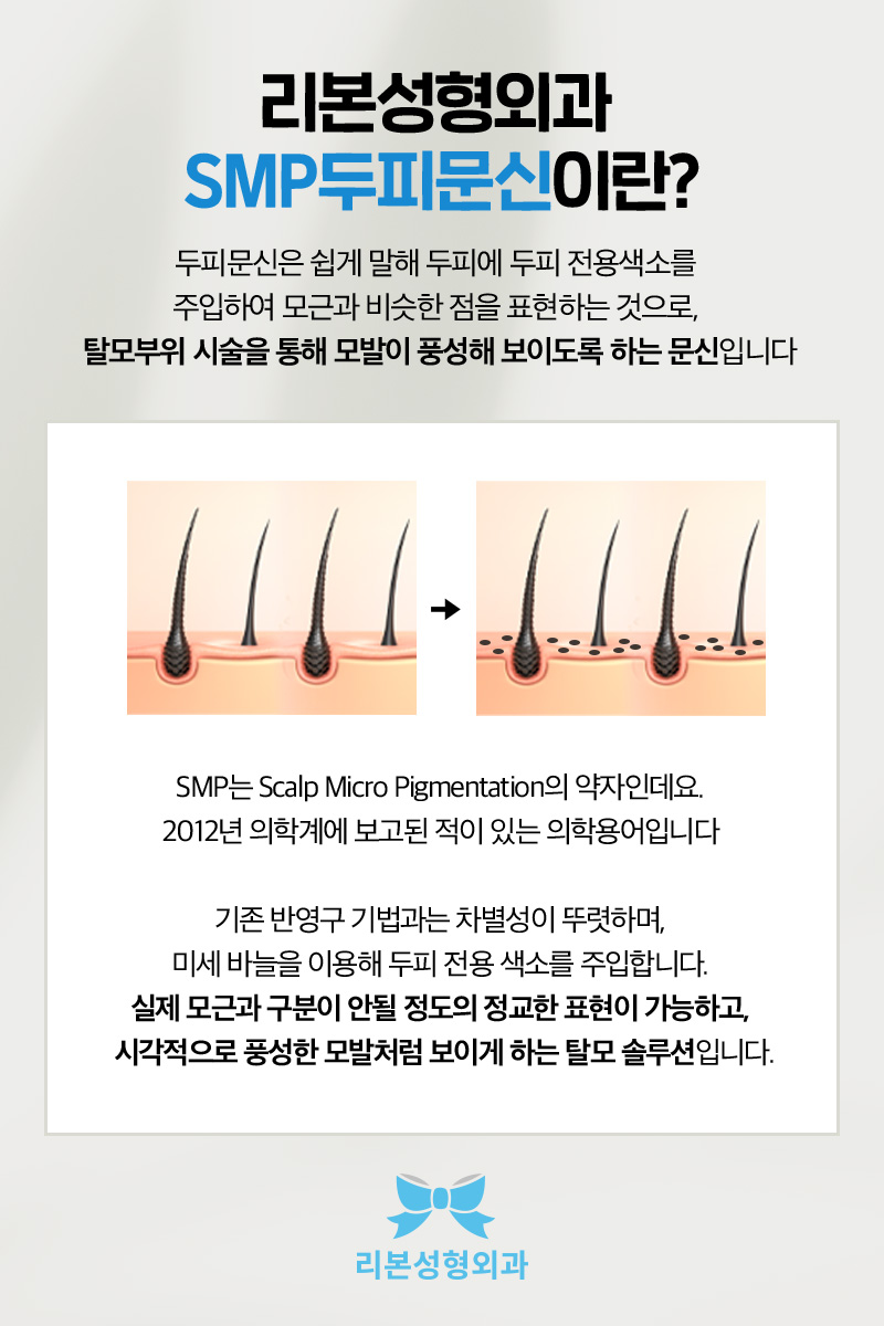 SMP두피문신 성형외과 A부터 Z까지 완벽하게 정리해 드릴게요. 관련 이미지 2