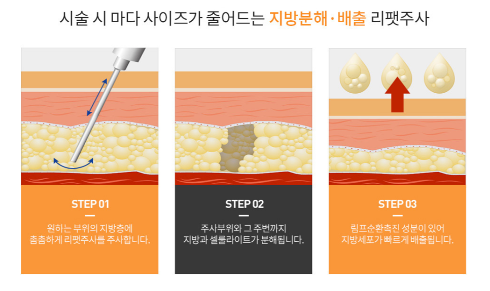 압구정동 지방분해주사 가격, 비용 궁금하신 분들 관련 이미지 5