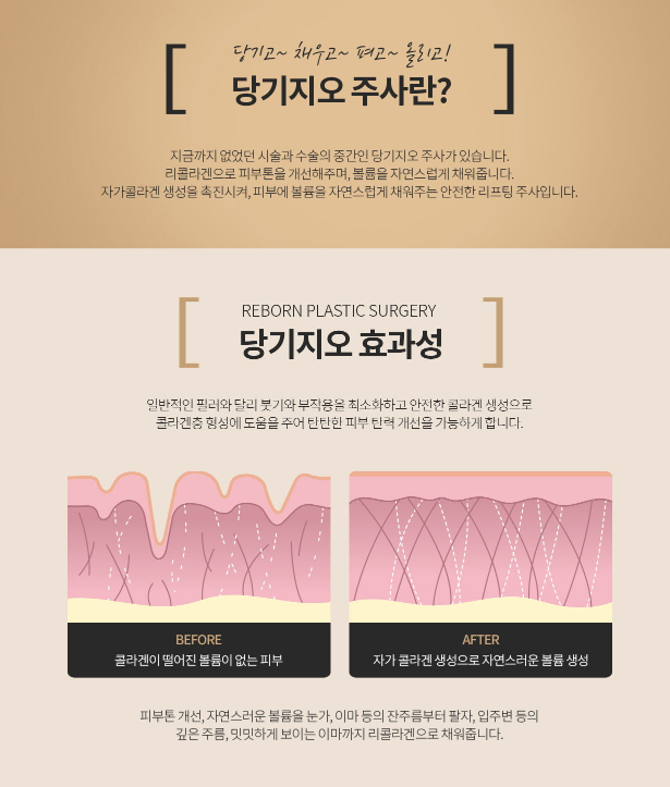 당기지오 눈 밑을 채워서 환하게! 관련 이미지 3