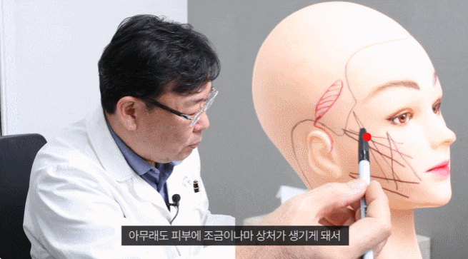 논현 실리프팅 잘하는 성형외과 관련 이미지 5