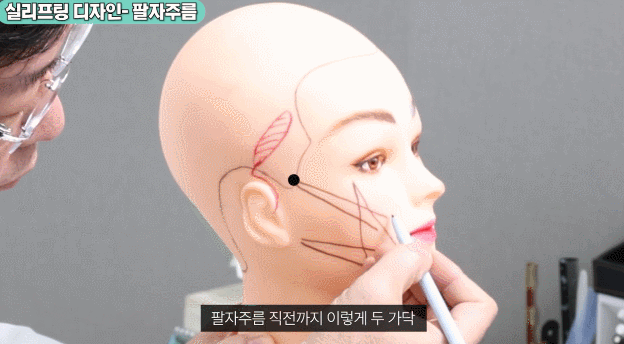 Precautions Mentioned by a Plastic Surgery Clinic for Thread Lifting at Sinsa Station image 3