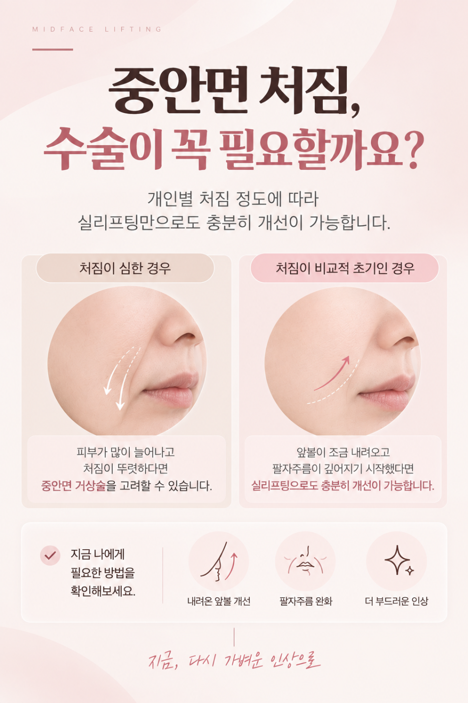 중안면 거상 수술이 아닌 실리프팅으로 충분히 효과 볼 수 있는 유형은 관련 이미지 2