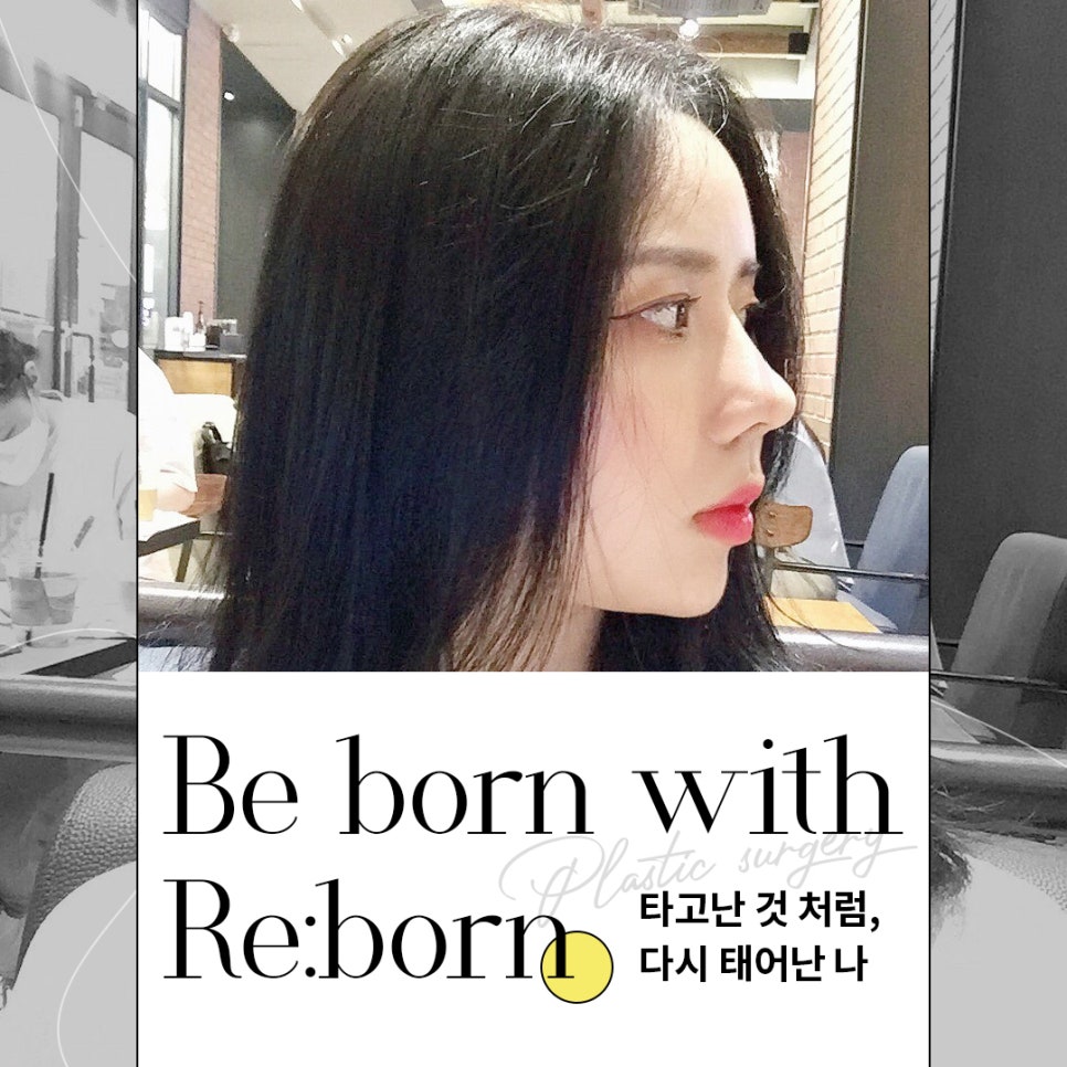 압구정코재수술 비용 만큼, 따져야 할 것 관련 이미지 1