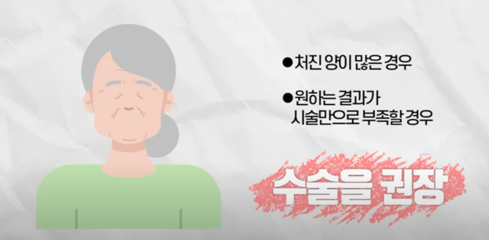 미니리프팅 효과 보고 후기쓰고 싶다면 feat 박재현 원장 관련 이미지 10