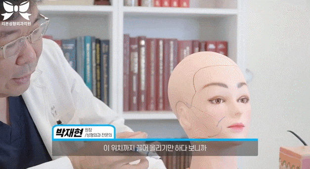 신논현 안면거상술? 쓰리스텝 관자거상에 대해 정리합니다. 관련 이미지 4