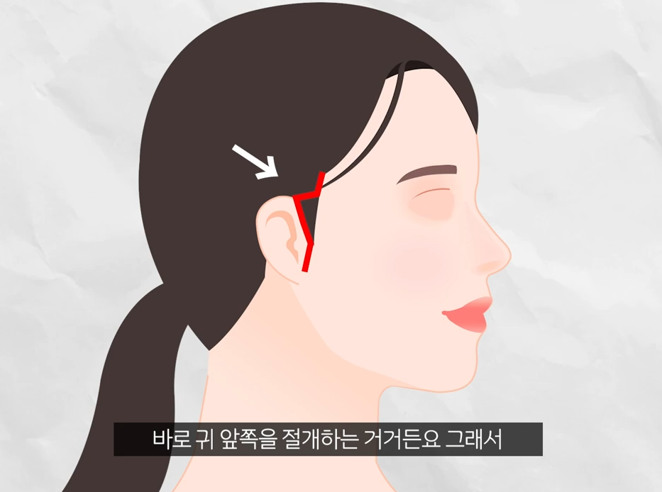 강남 미니거상 효과 잘 보려면 이게 포인트 관련 이미지 5