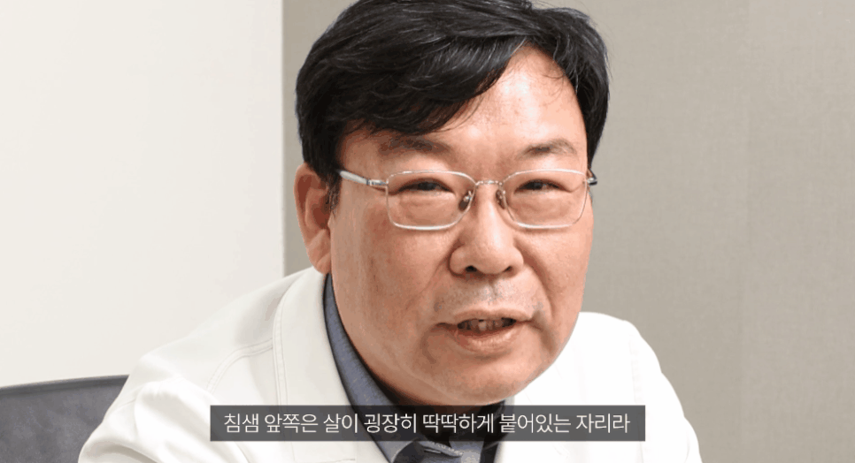 Sinsa Station Facial Thread Lifting: Concerned About Nasolabial Folds, Marionette Lines, or Deep Cheek Fat? image 4