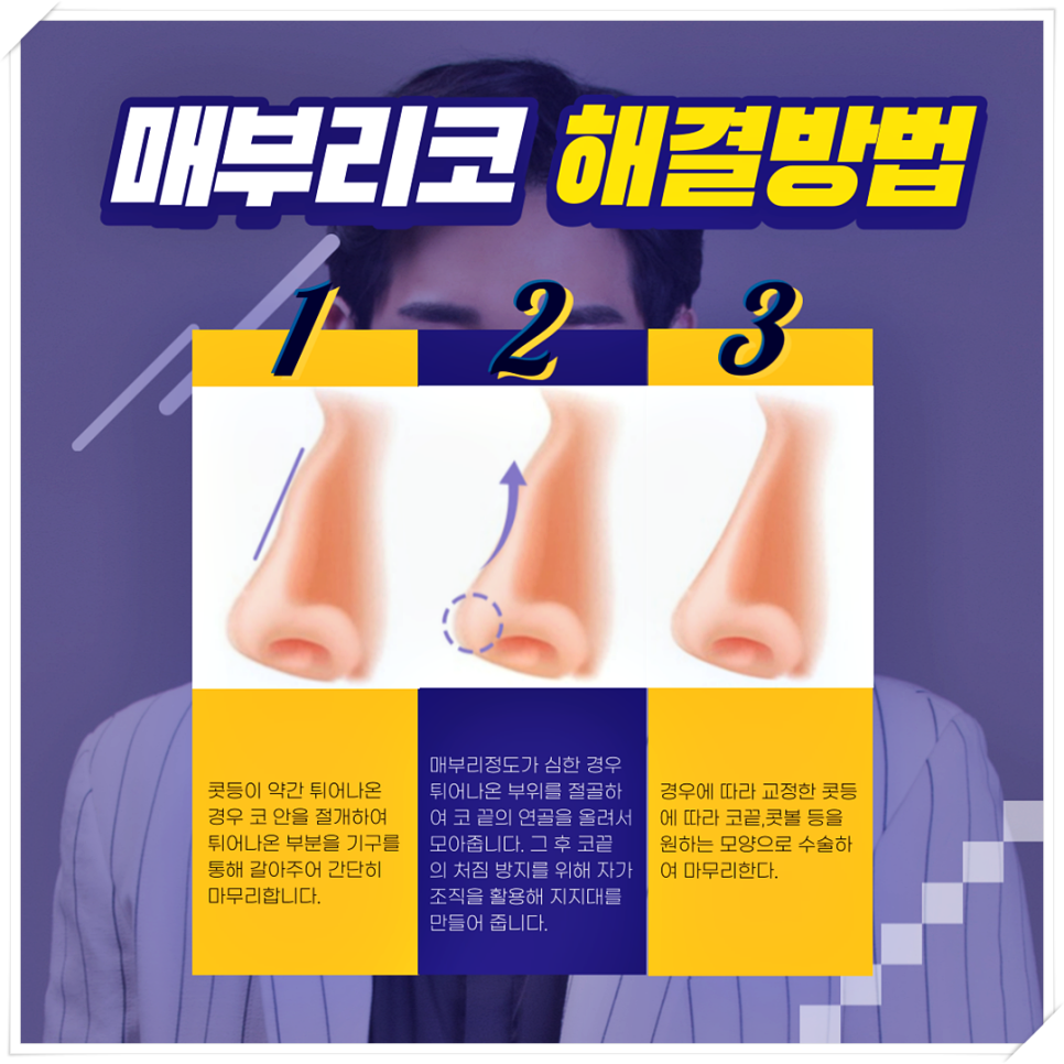 매부리코관상 해결해서 훈남/훈녀 되기! 관련 이미지 3