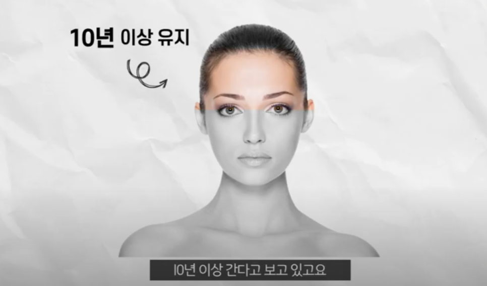미니리프팅 효과 보고 후기쓰고 싶다면 feat 박재현 원장 관련 이미지 8