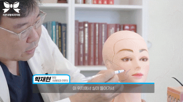 실리프팅 광대 커짐 부작용 원치 않는다면... 관련 이미지 6
