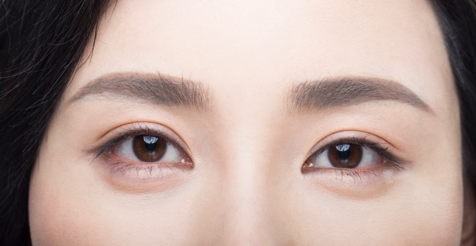 Midlife Eye Surgery Price, Is Cost Really Important? image 5