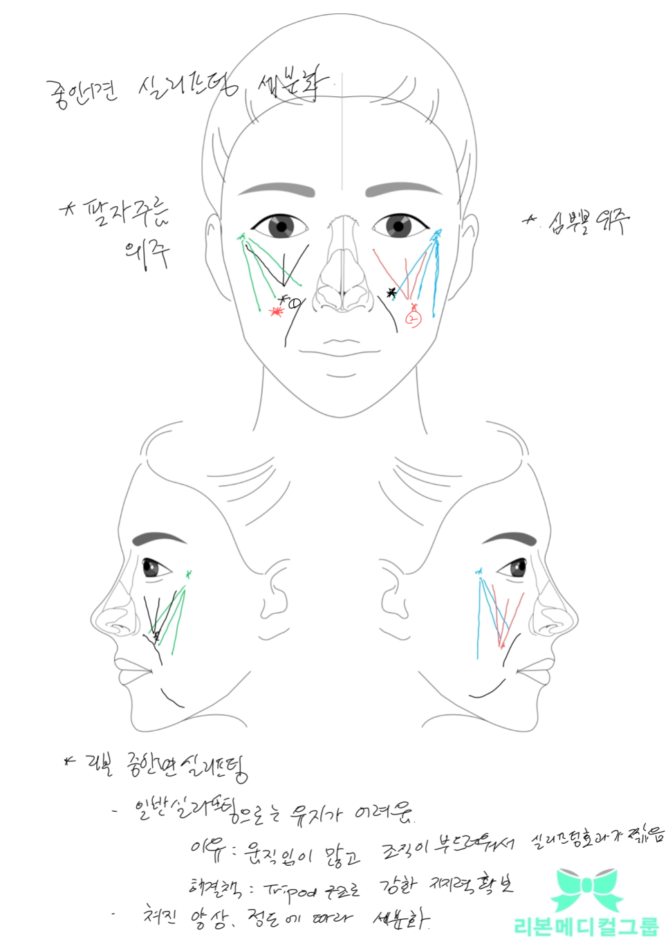 중안면리프팅 가격, 비용만 보고 결정하면 안 됩니다. 관련 이미지 3