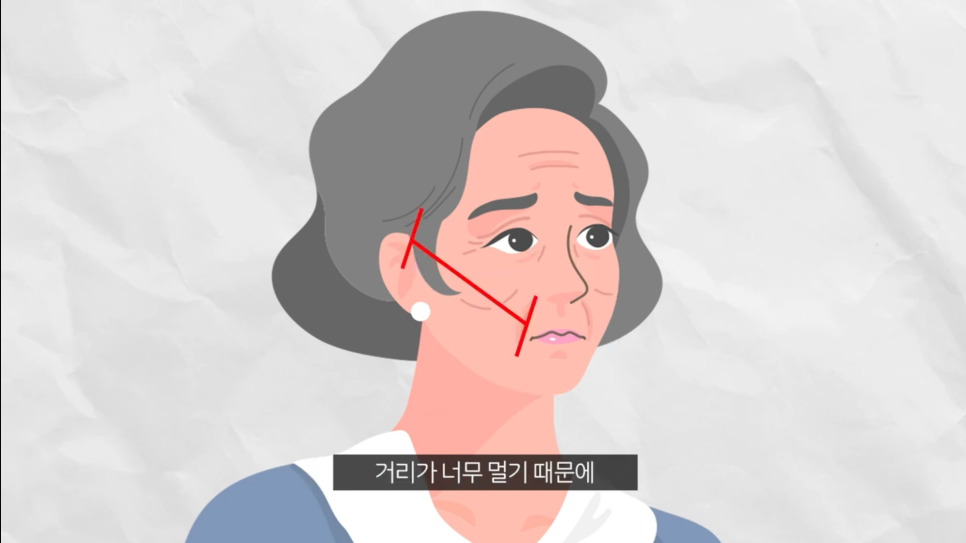 안면거상후기 미니안면거상 내돈내산 하기 전에 관련 이미지 6
