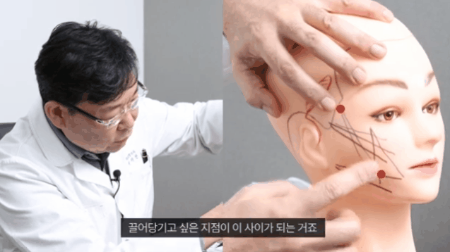 Sagging Face Lifting Price: Cost Is Not Very Important image 3