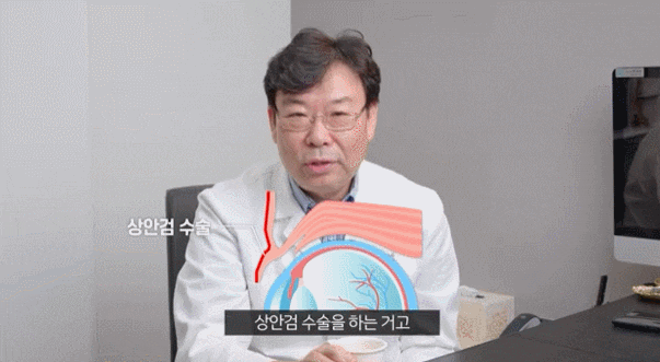 상안검 하안검수술 전후사진 찾는 분들에게... 관련 이미지 7