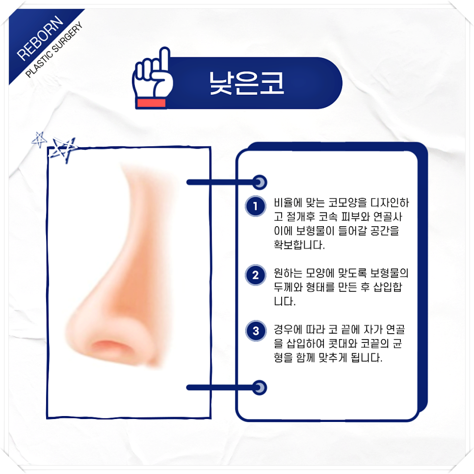 코 모양 종류 어떤 것도 상관없이 예쁜 코 만드세요! 관련 이미지 2
