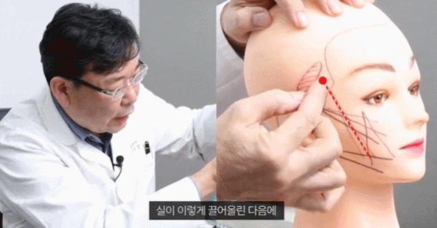 신사동 실리프팅 관련 이미지 5