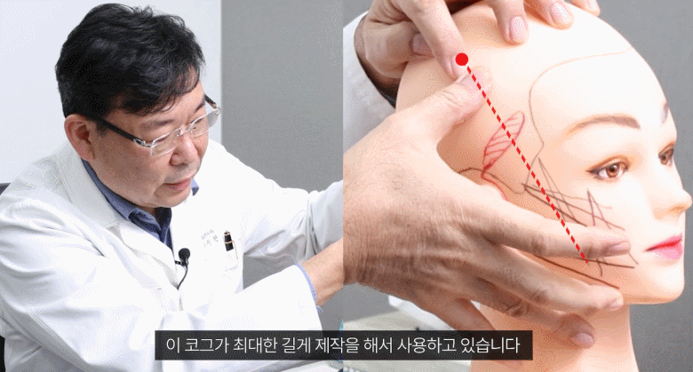 관자놀이리프팅 거상 받기 전에 필독해주세요 관련 이미지 3