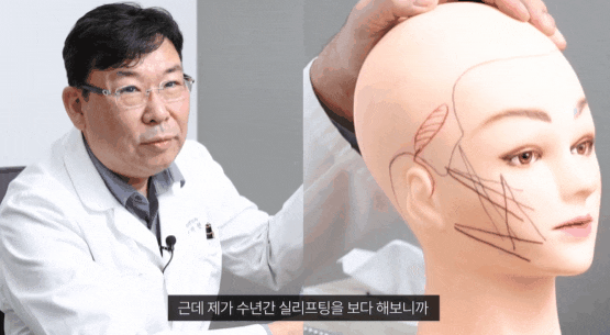 신사 리프팅 잘하는곳 실 종류에 따라 만족도 다를까? 관련 이미지 5