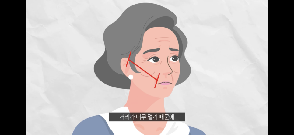 압구정리프팅 팔자주름거상에 실 필요?(feat.리본성형외과) 관련 이미지 6