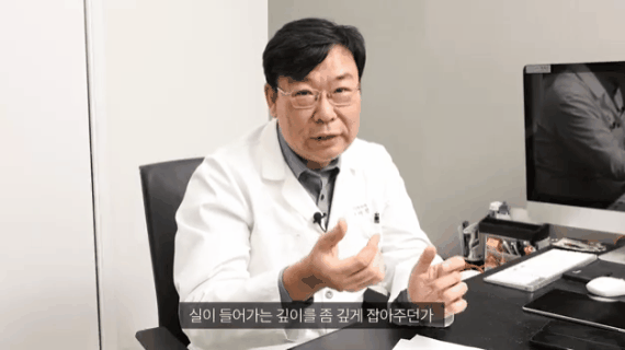Why a Midface Lift Review Shows That a Facelift May Not Be Necessary image 3