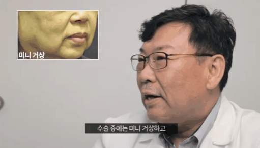 Why Is Thread Lifting Recommended at the Sinsa-dong Plastic Surgery Clinic? image 2