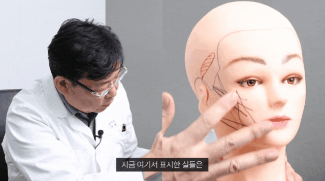 중안부실리프팅 후기 전후사진 보고 시술 결정하지 마세요 관련 이미지 1