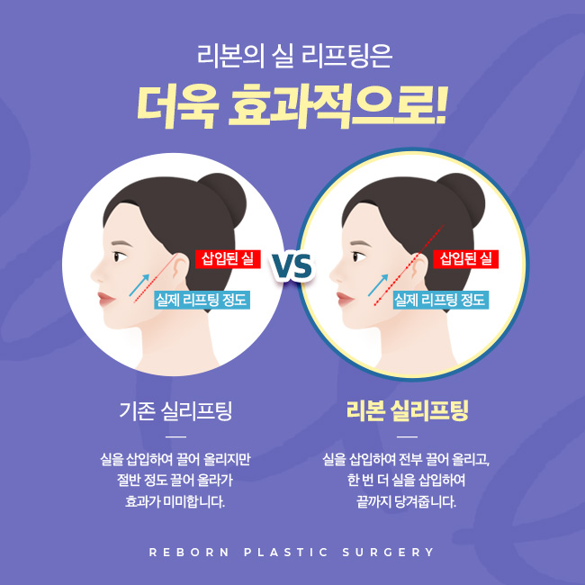 신논현역성형외과 동안의 피부로 거듭나기 관련 이미지 5