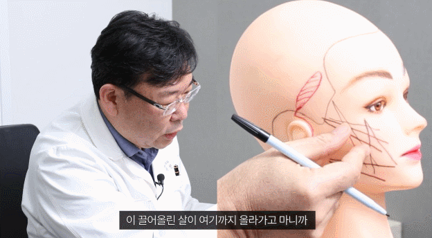 Precautions Mentioned by a Plastic Surgery Clinic for Thread Lifting at Sinsa Station image 4
