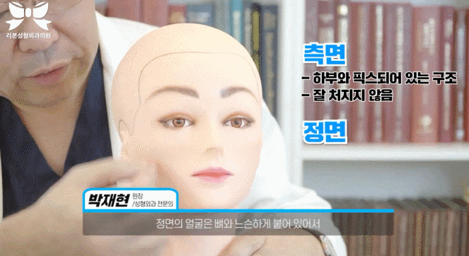 신사역 안면거상술 관련 이미지 4