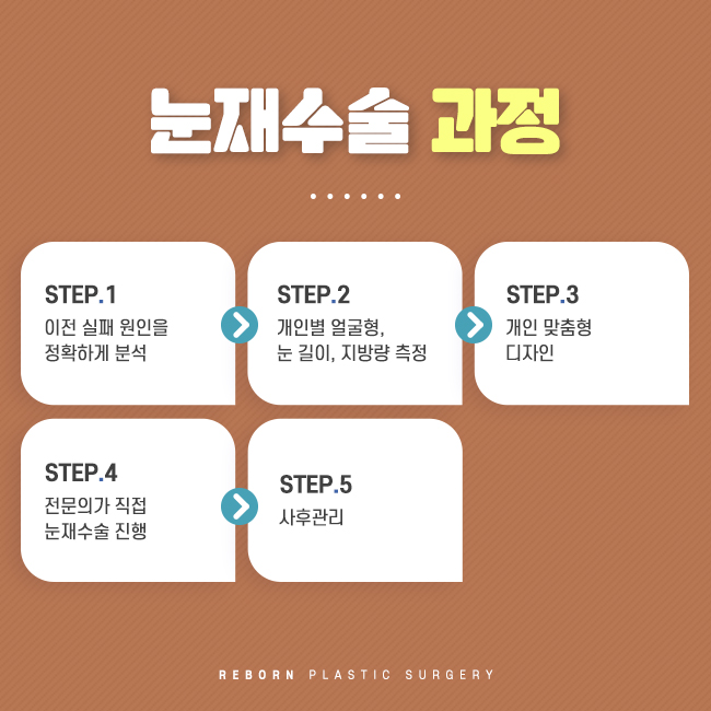 압구정눈재수술 아름다운 마침표 관련 이미지 2