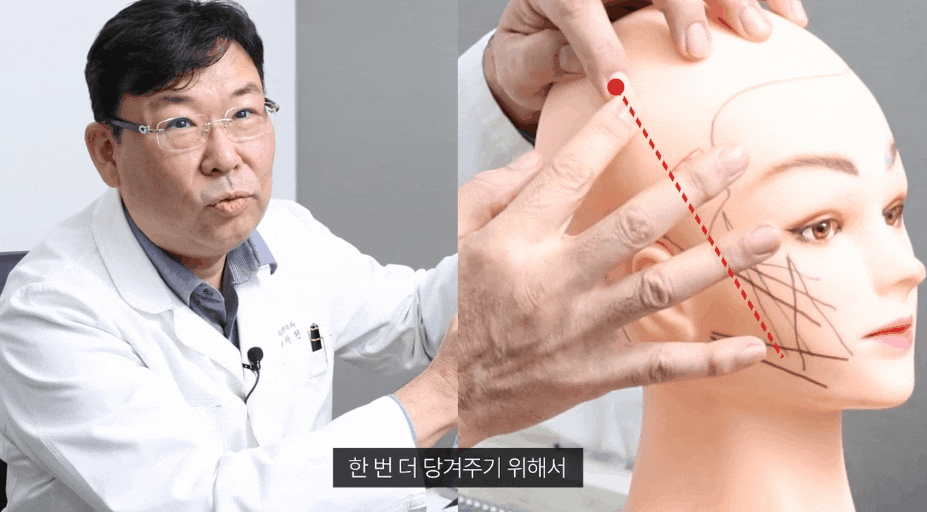 압구정 실리프팅 잘하는 성형외과 SNS 후기만 보고 결정하면..? 관련 이미지 4