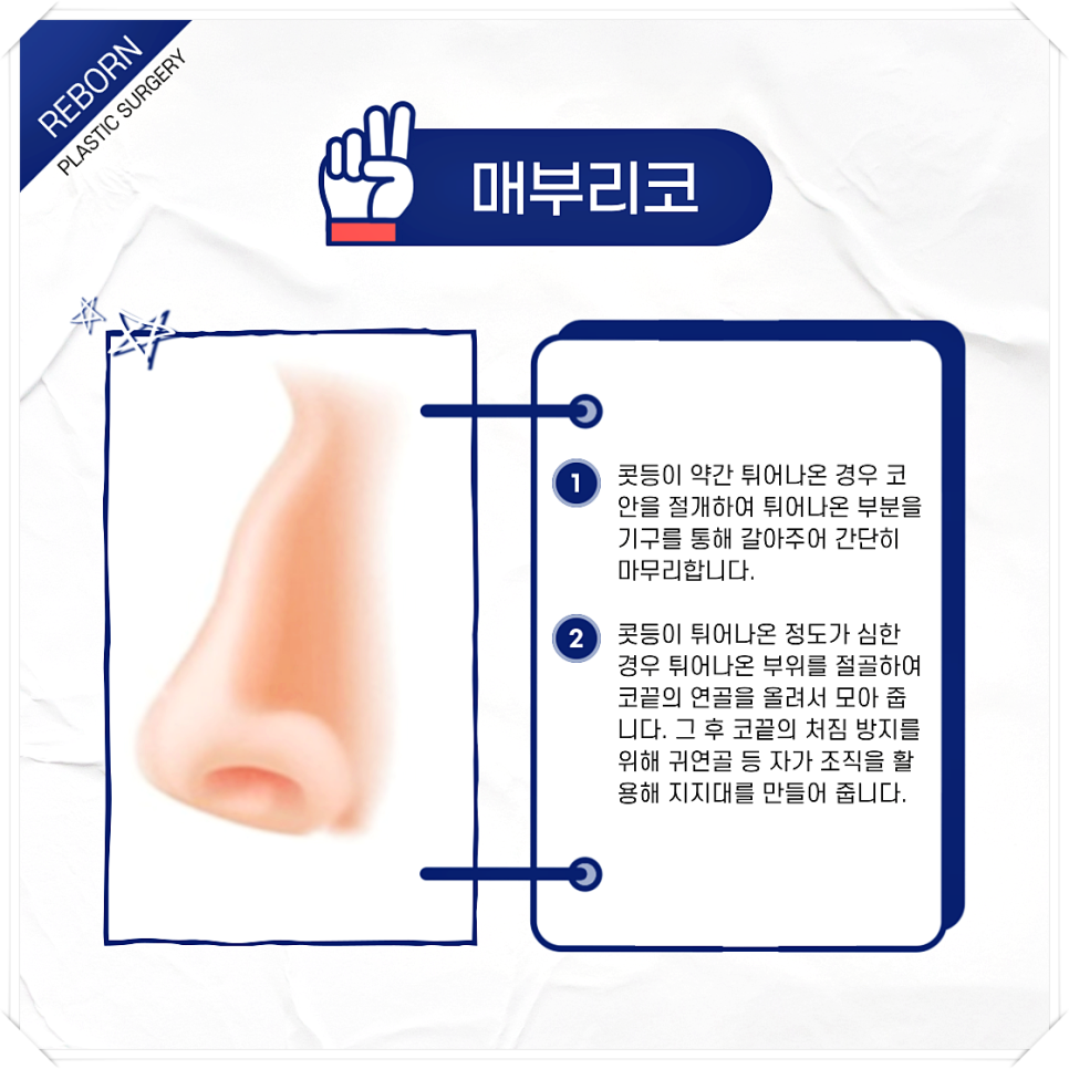 코 모양 종류 어떤 것도 상관없이 예쁜 코 만드세요! 관련 이미지 3