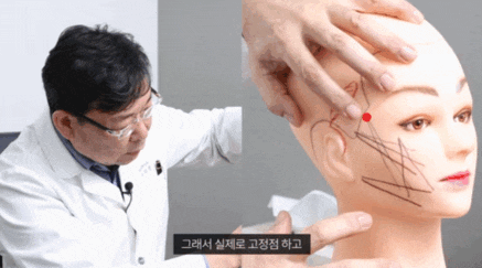 처진 얼굴 실리프팅 광대 커짐을 예방하려면? 관련 이미지 3