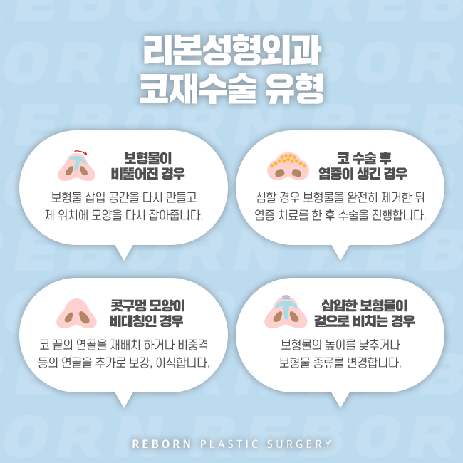 논현역성형외과 코재수술을 기억해 관련 이미지 3