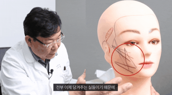신사 리프팅 잘하는곳 실 종류에 따라 만족도 다를까? 관련 이미지 3