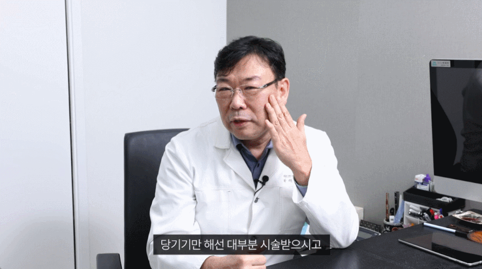 Silifting for Nasolabial Folds, Especially image 2