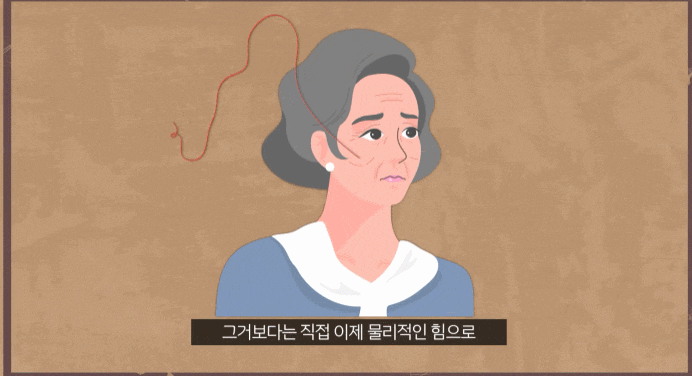 모노실 리프팅 코그실, 콘실 종류별 특징과 단점 보완하는 방법 관련 이미지 1