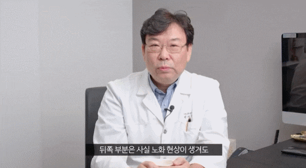 상안검 하안검수술 전후사진 찾는 분들에게... 관련 이미지 6