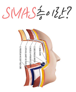 강남 안면거상술 후기, 얼굴 전반적 처짐개선에 효과적 관련 이미지 2